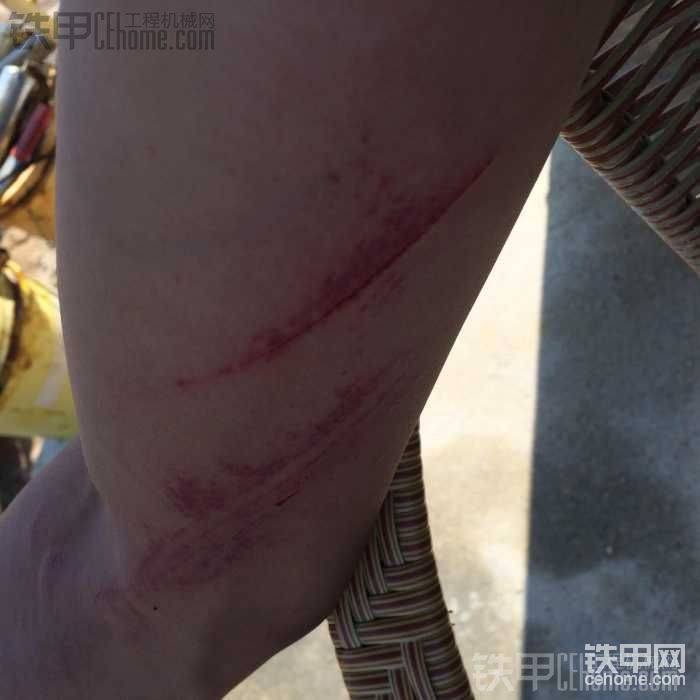 停好車(chē)下車(chē)沒(méi)站穩(wěn)摔了，