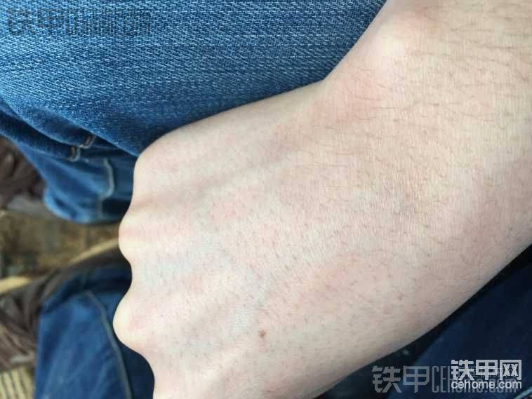 我的手白不白？