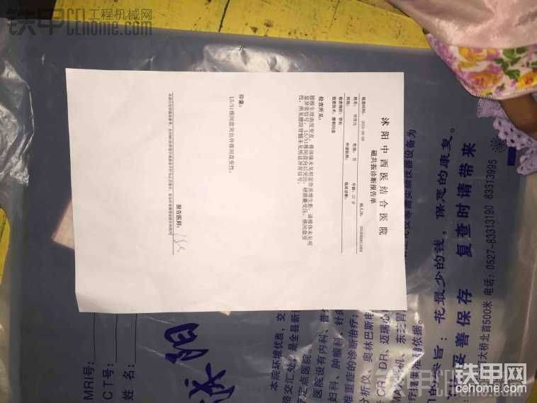 腰尖盘突出