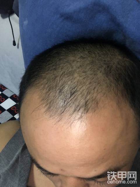 学一门技术